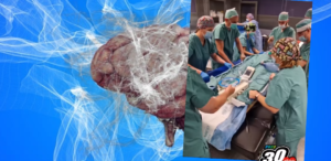 Przełomowa operacja mózgu w Polsce. Centrum Zdrowia Dziecka ogłosiło sukces
